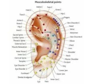 auriculotherapie door acupuntuur punten problemen aanpakken